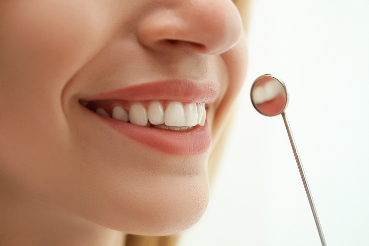 Woman showing bright healthy smile after cosmetic treatment for white spots